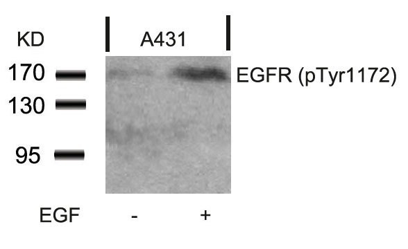 Anti-Phospho-EGFR (Tyr1172) Polyclonal Antibody