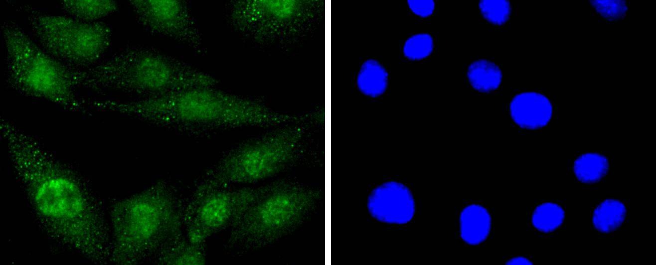 Anti-EGFR Antibody (2W575)