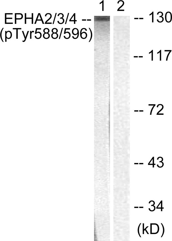 Anti-Phospho-EphA2/3/4 (Tyr588/596) Polyclonal Antibody