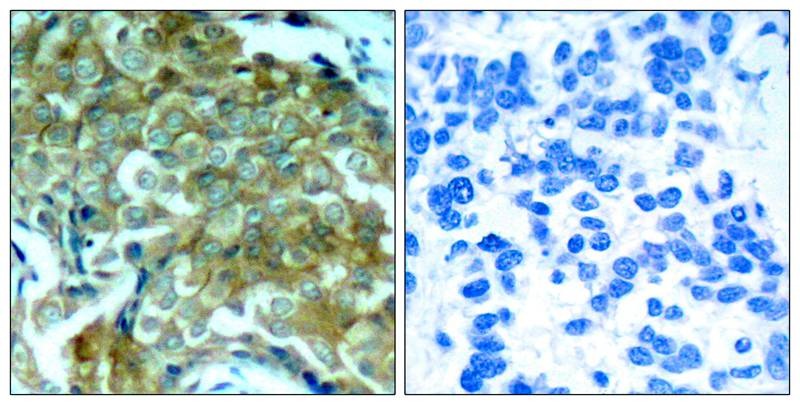 Anti-Phospho-EGFR (Tyr1172) Polyclonal Antibody