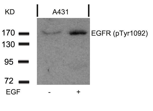 Anti-Phospho-EGFR (Tyr1092) Polyclonal Antibody