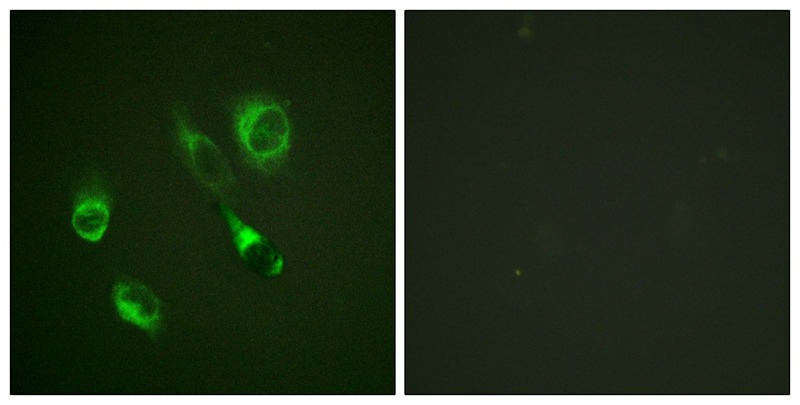 Anti-Phospho-EphA2/3/4 (Tyr588/596) Polyclonal Antibody