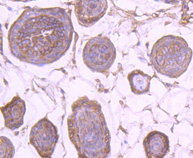 Anti-EGFR Antibody (2W575)