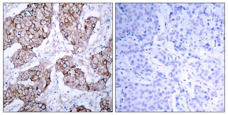 Anti-Phospho-EGFR (Tyr1092) Polyclonal Antibody