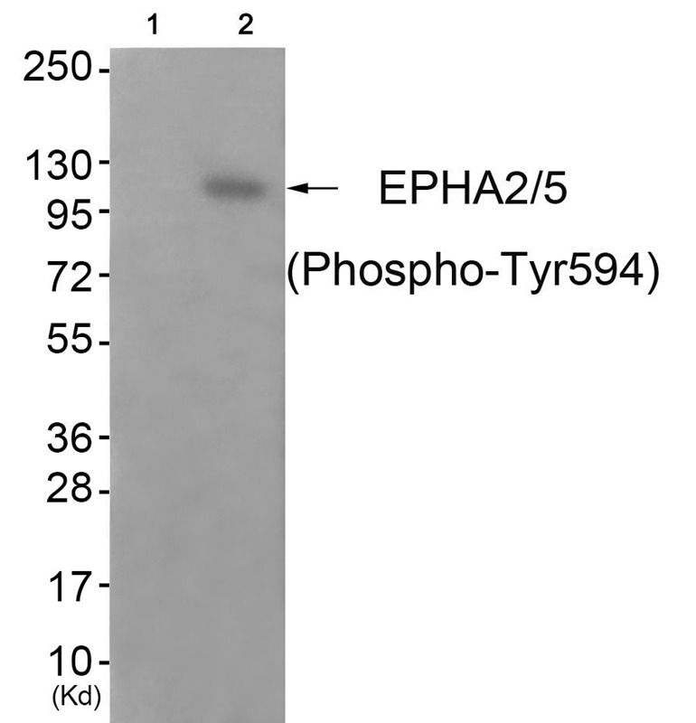Anti-Phospho-EphA2/5 (Tyr594) Polyclonal Antibody