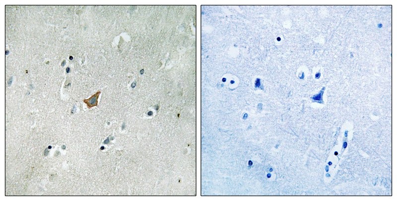 Anti-Phospho-EphA3/4/5 (Tyr779/833) Polyclonal Antibody