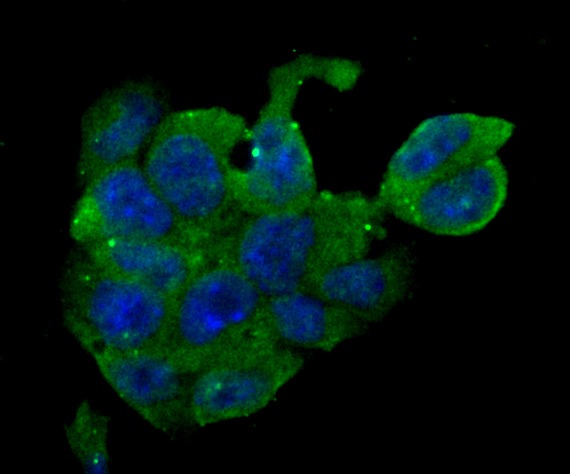 Anti-ERP29 Antibody (2E160)
