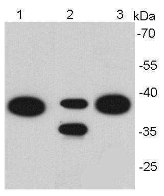 Anti-EpCAM/TROP1 Antibody (9A610)