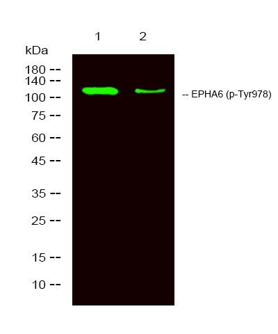 Anti-Phospho-EphA6 (Tyr977) Polyclonal Antibody
