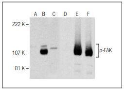 Anti-Phospho-PTK2 (Ser 722) Antibody (7J439)