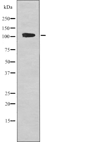 Anti-Phospho-EphA1 (Tyr599) Polyclonal Antibody