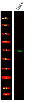 Anti-Phospho-EIF5 (Ser389, 390) Polyclonal Antibody
