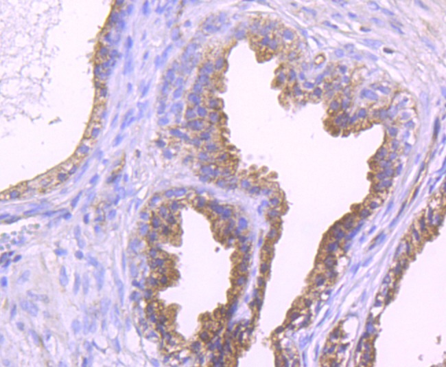Anti-Epac1 Antibody (3T871)