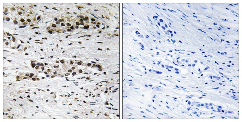 Anti-Phospho-ER alpha (Ser102) Polyclonal Antibody