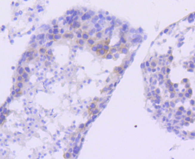 Anti-FANCD2 Antibody (8B144)