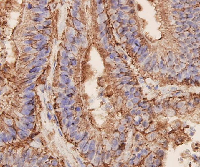 Anti-EpCAM/TROP1 Antibody (9A610)