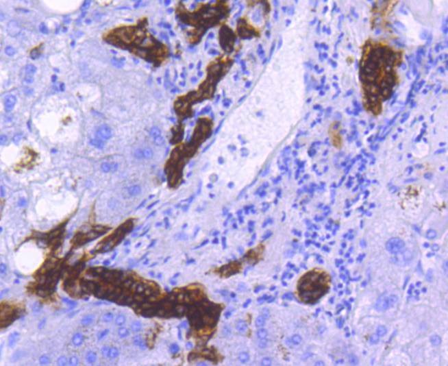 Anti-EpCAM/TROP1 Antibody (1I547)