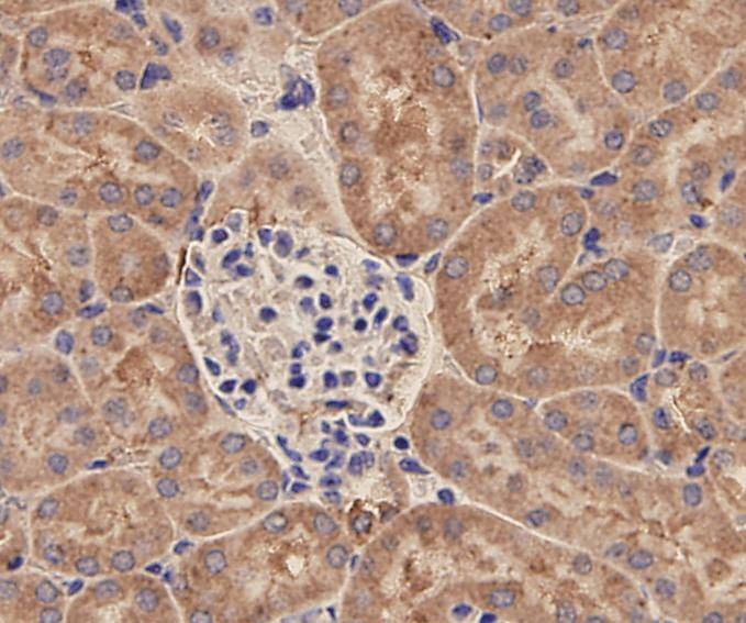 Anti-EpCAM/TROP1 Antibody (9A610)