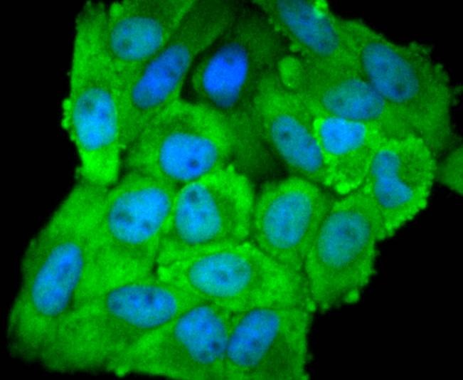 Anti-EIF5A Antibody (9P939)