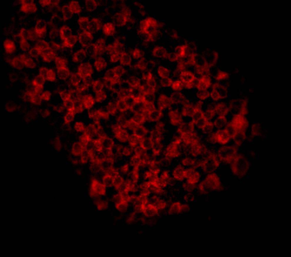 Anti-EpCAM/TROP1 Antibody (9A610)
