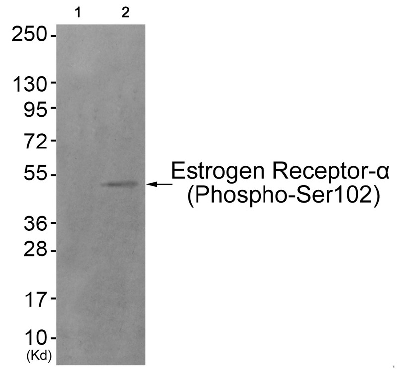 Anti-Phospho-ER alpha (Ser102) Polyclonal Antibody