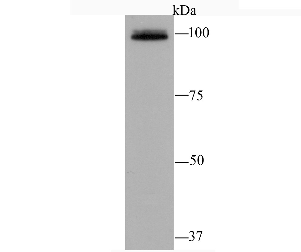 Anti-Epac1 Antibody (3T871)