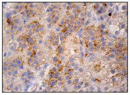 Anti-Phospho-PTK2 (Ser 722) Antibody (7J439)