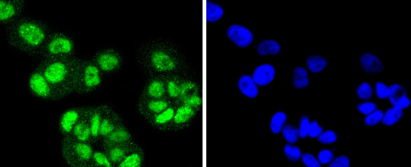Anti-FANCD2 Antibody (8B144)
