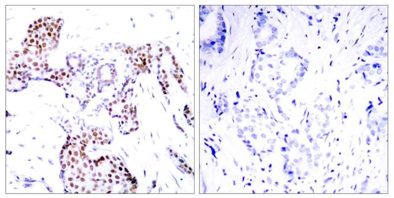 Anti-Phospho-ELK1 (Ser389) Polyclonal Antibody