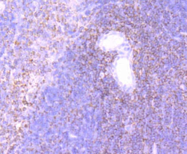 Anti-ELMO1 Antibody (8W516)