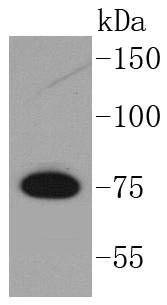 Anti-GARS Antibody (2F92)