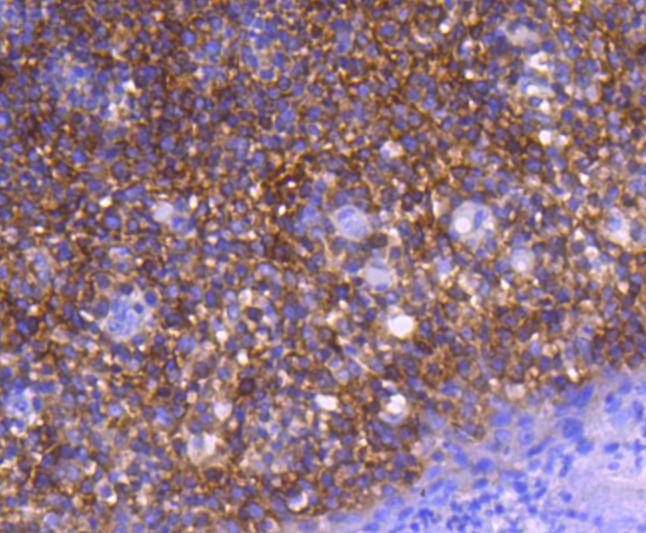 Anti-GART Antibody (9K216)