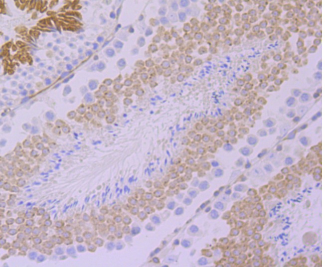 Anti-GEF H1 Antibody (3H958)