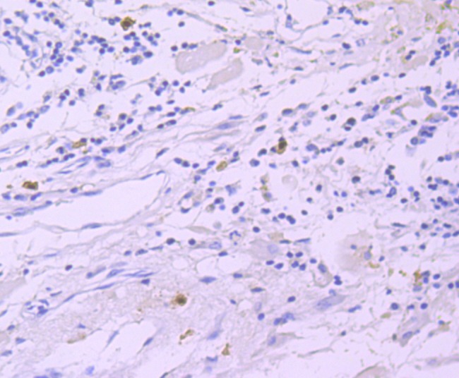 Anti-GATA1 Antibody (4D22)