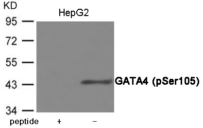 Anti-Phospho-GATA4 (Ser105) Polyclonal Antibody