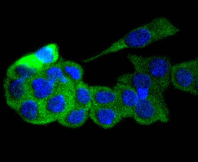 Anti-GART Antibody (9K216)