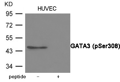 Anti-Phospho-GATA3 (Ser308) Polyclonal Antibody