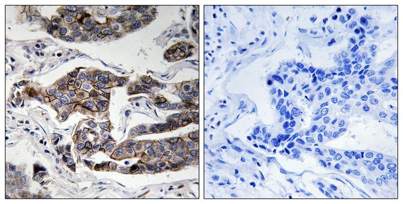 Anti-Phospho-Girdin (Ser1417) Polyclonal Antibody