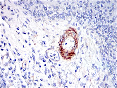 Anti-GKAP Antibody (3C392)