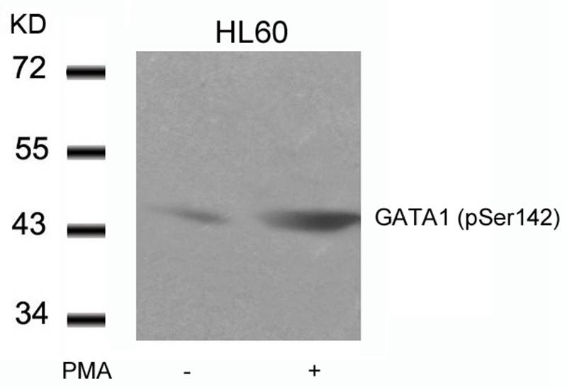 Anti-Phospho-GATA1 (Ser142) Polyclonal Antibody