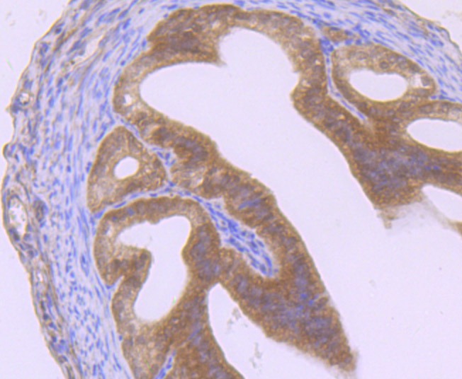 Anti-GIT1 Antibody (6A39)