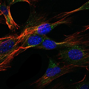 Anti-GKAP Antibody (3C392)