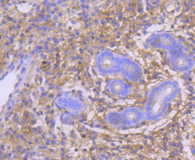 Anti-GART Antibody (9K216)