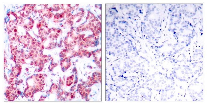 Anti-Phospho-GATA1 (Ser142) Polyclonal Antibody