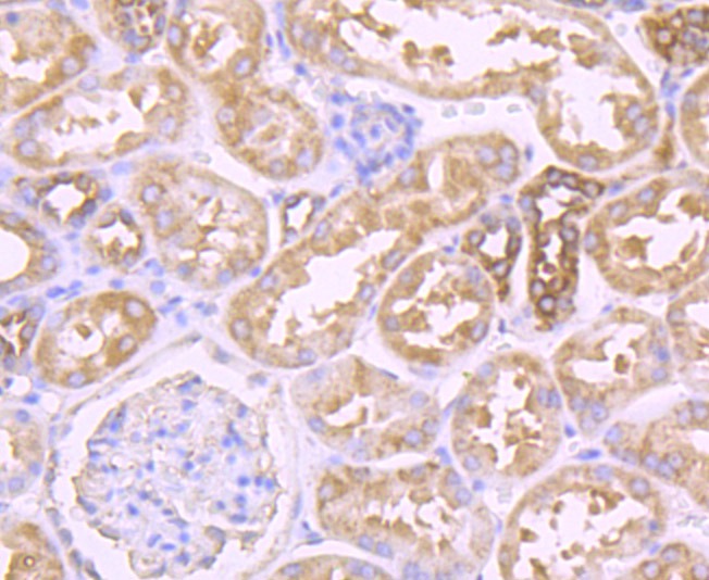 Anti-PFKM Antibody (4A746)