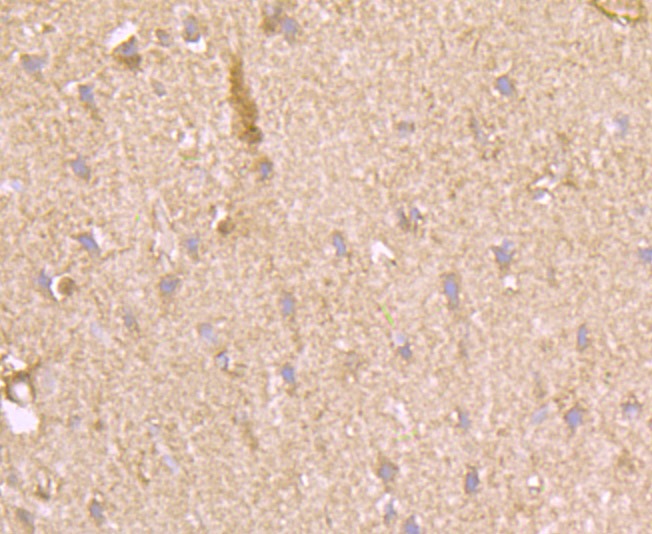 Anti-PFKM Antibody (4A746)