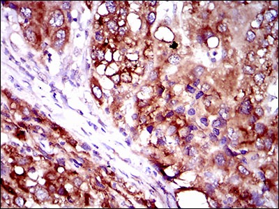 Anti-FATP2 Antibody (4L226)