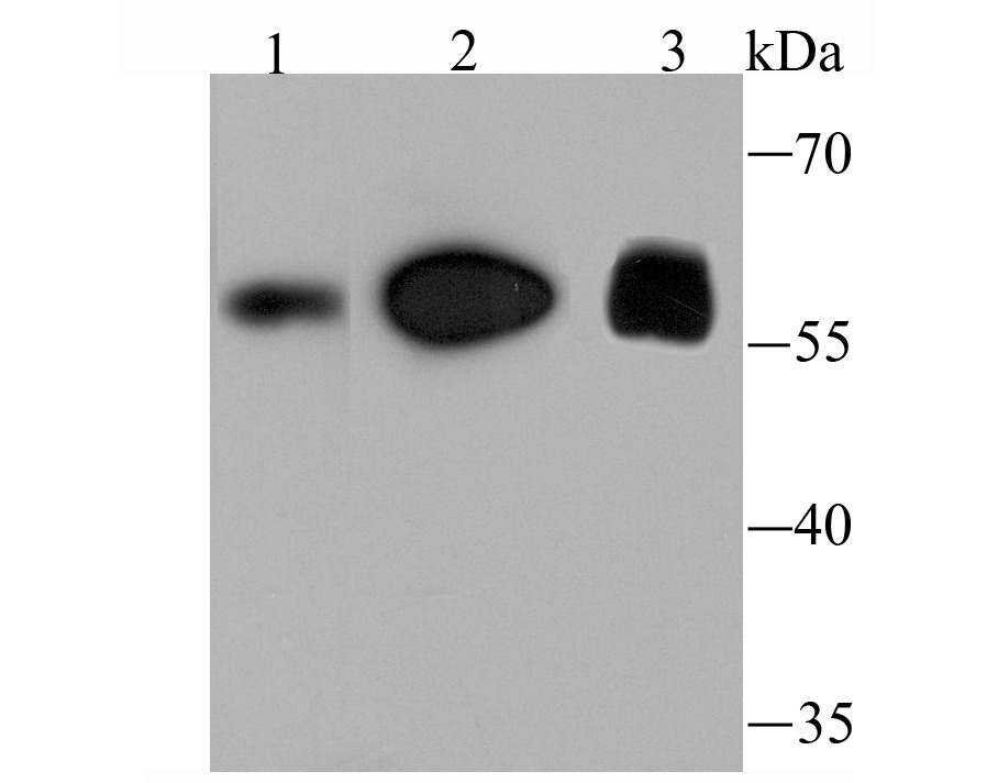 Anti-FTO Antibody (6A98)