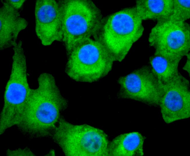 Anti-FASN Antibody (5Z147)