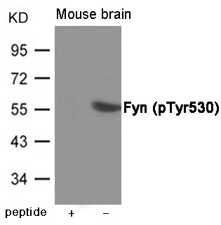 Anti-Phospho-FYN (Tyr530) Polyclonal Antibody
